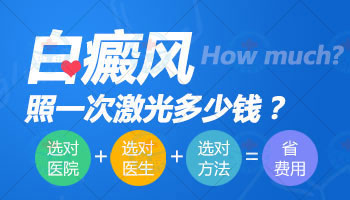 白斑照一次308激光多少钱按什么收费