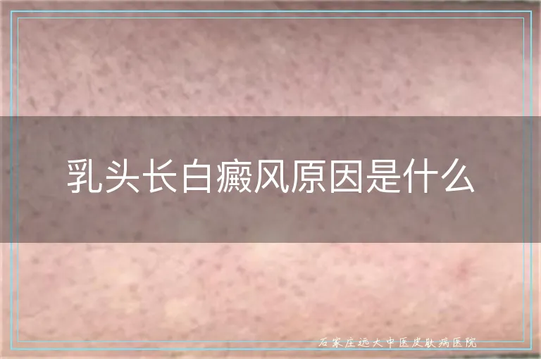 乳头长白癜风原因是什么