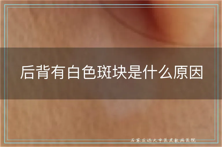 后背有白色斑块是什么原因