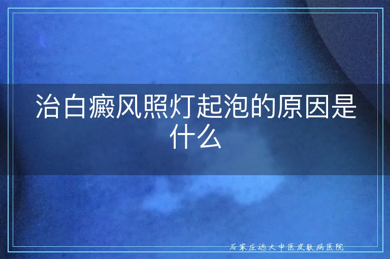 治白癜风照灯起泡的原因是什么