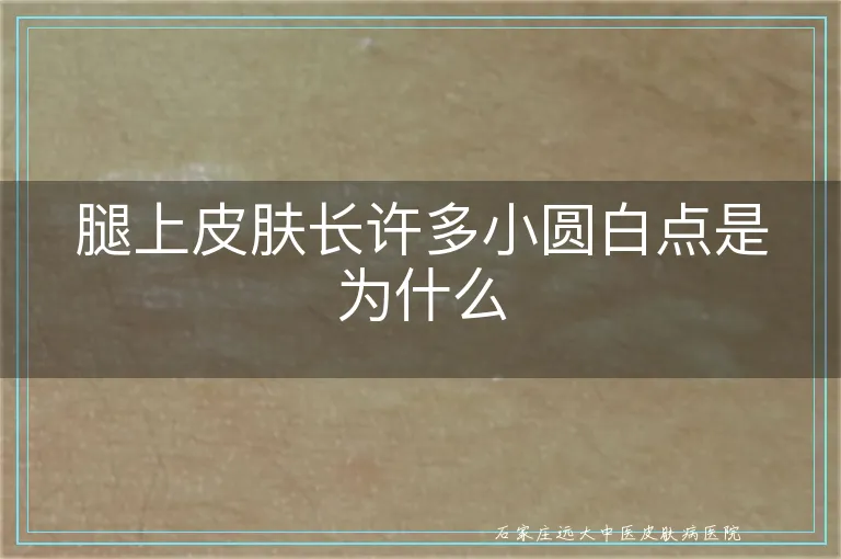 腿上皮肤长许多小圆白点是为什么