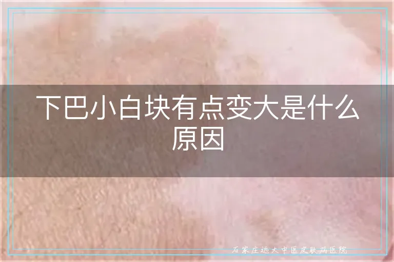 下巴小白块有点变大是什么原因