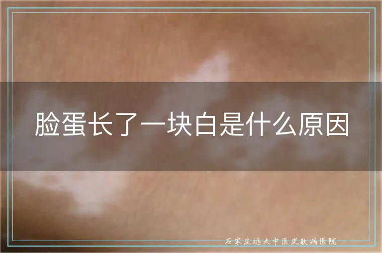 脸蛋长了一块白是什么原因