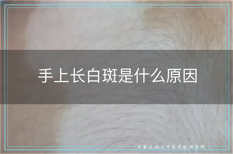 手上长白斑是什么原因