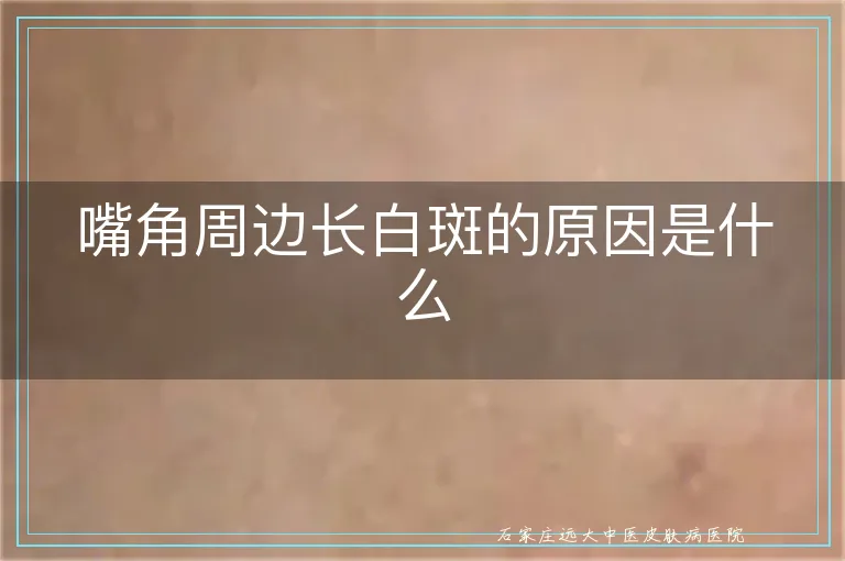 嘴角周边长白斑的原因是什么
