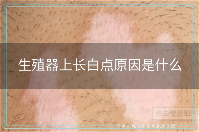 生殖器上长白点原因是什么