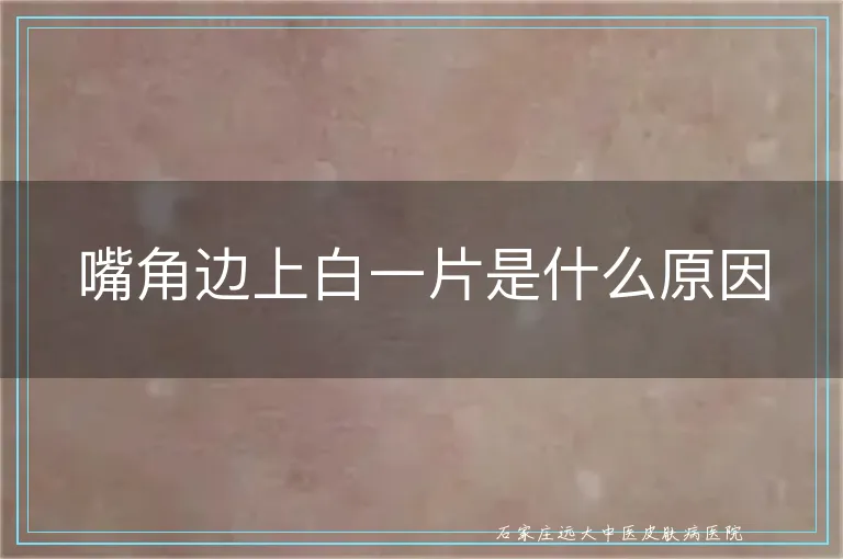 嘴角边上白一片是什么原因