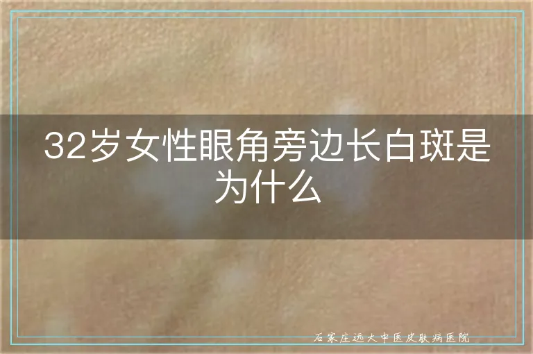32岁女性眼角旁边长白斑是为什么