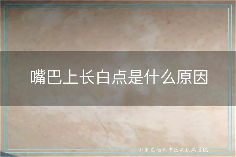 嘴巴上长白点是什么原因