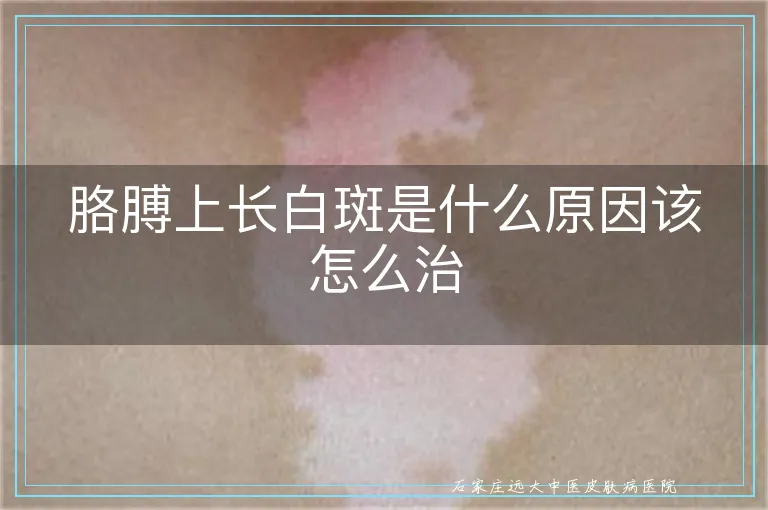 胳膊上长白斑是什么原因该怎么治
