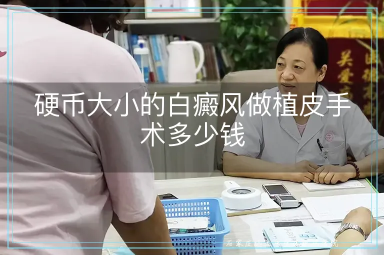 硬币大小的白癜风做植皮手术多少钱