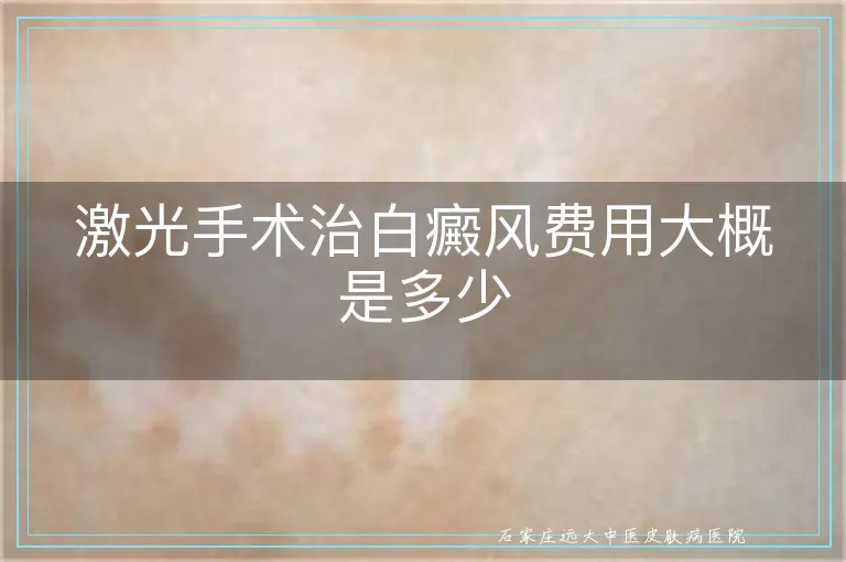 激光手术治白癜风费用大概是多少