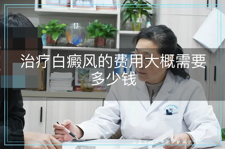 治疗白癜风的费用大概需要多少钱