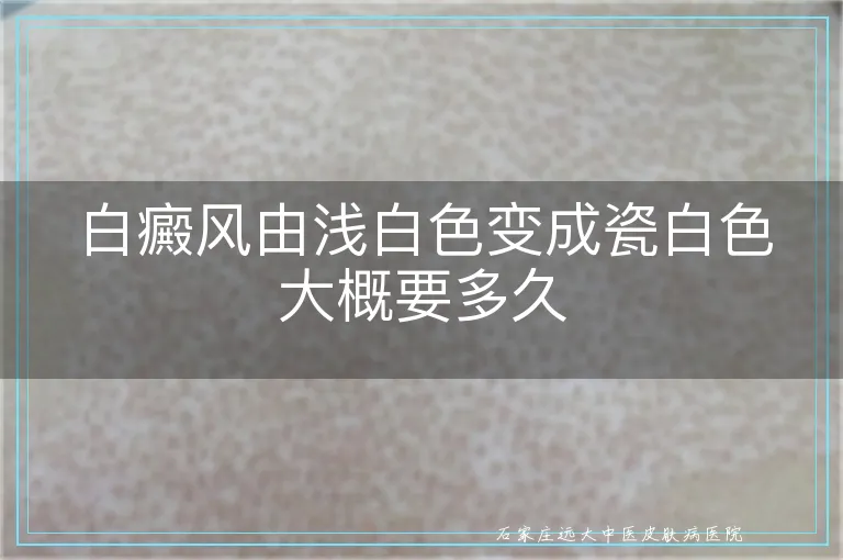 白癜风由浅白色变成瓷白色大概要多久