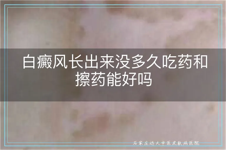 白癜风长出来没多久吃药和擦药能好吗