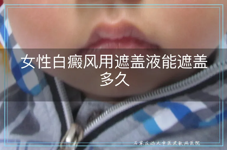 女性白癜风用遮盖液能遮盖多久