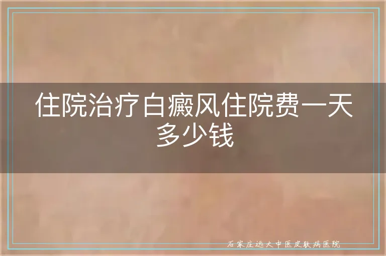 住院治疗白癜风住院费一天多少钱