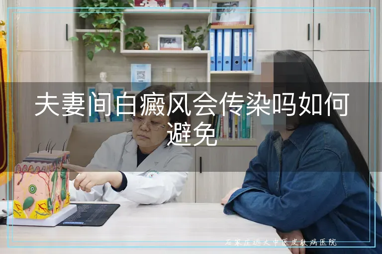 夫妻间白癜风会传染吗如何避免