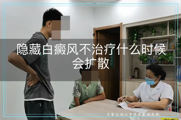 隐藏白癜风不治疗什么时候会扩散