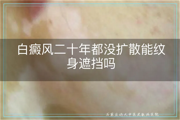 白癜风二十年都没扩散能纹身遮挡吗