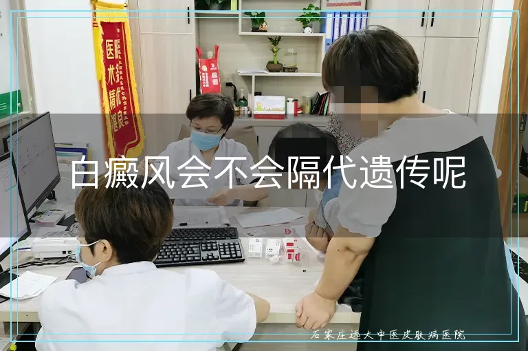 白癜风会不会隔代遗传呢