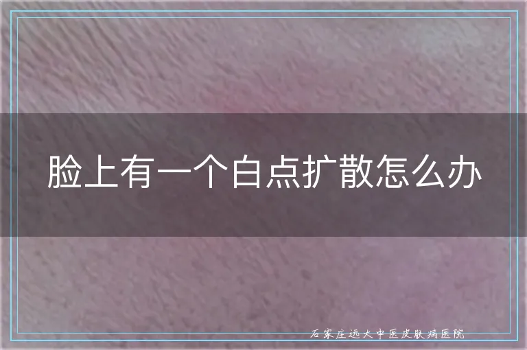 脸上有一个白点扩散怎么办