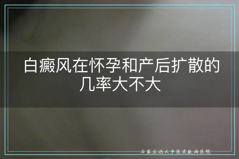 白癜风在怀孕和产后扩散的几率大不大