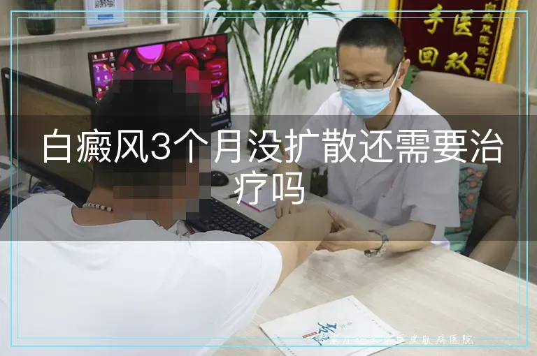 白癜风3个月没扩散还需要治疗吗