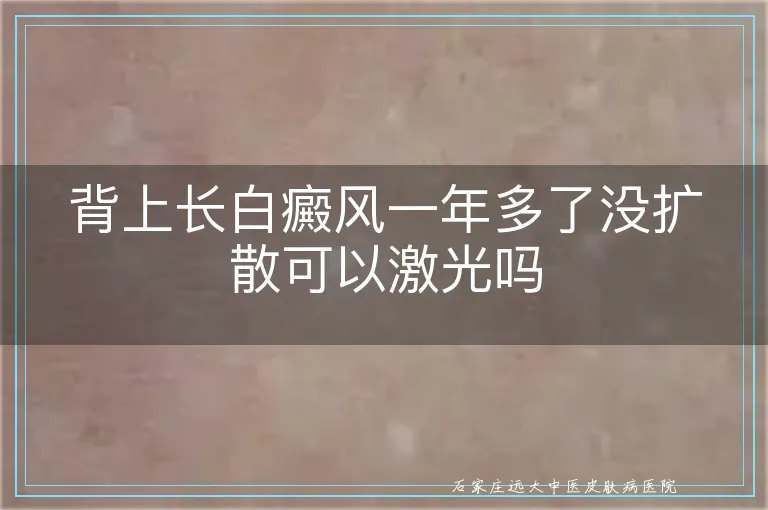 背上长白癜风一年多了没扩散可以激光吗