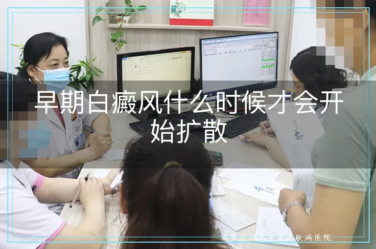 早期白癜风什么时候才会开始扩散