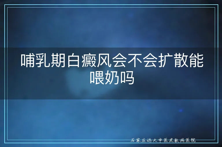 哺乳期白癜风会不会扩散能喂奶吗