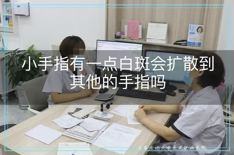 小手指有一点白斑会扩散到其他的手指吗