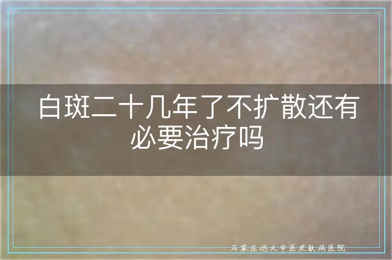 白斑二十几年了不扩散还有必要治疗吗