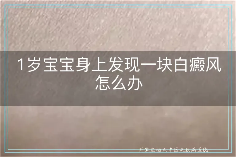 1岁宝宝身上发现一块白癜风怎么办