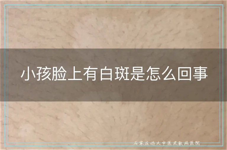 小孩脸上有白斑是怎么回事