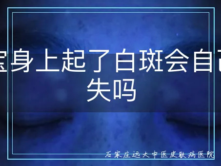 宝宝身上起了白斑会自己消失吗