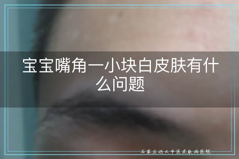 宝宝嘴角一小块白皮肤有什么问题