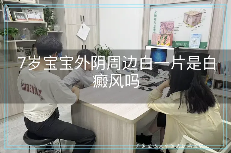 7岁宝宝外阴周边白一片是白癜风吗