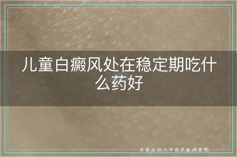 儿童白癜风处在稳定期吃什么药好