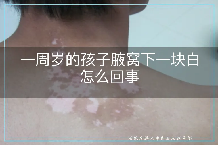 一周岁的孩子腋窝下一块白怎么回事