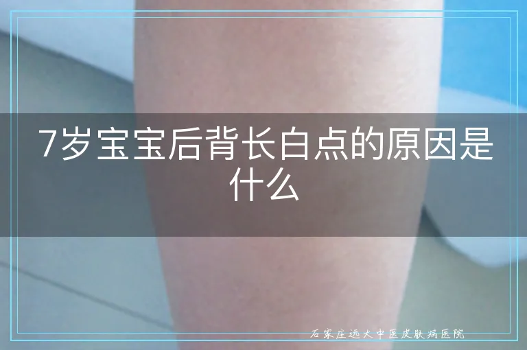7岁宝宝后背长白点的原因是什么