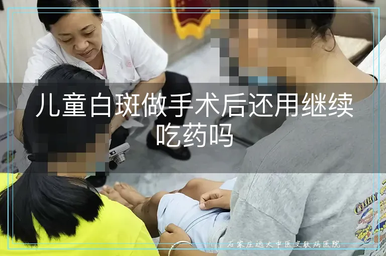 儿童白斑做手术后还用继续吃药吗
