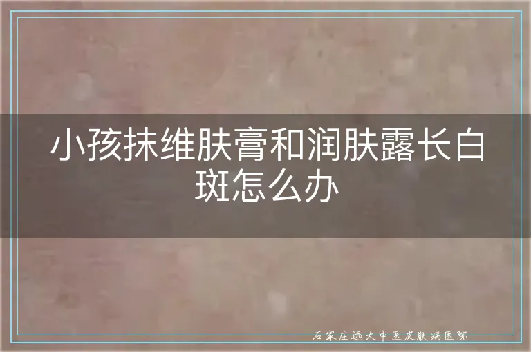 小孩抹维肤膏和润肤露长白斑怎么办