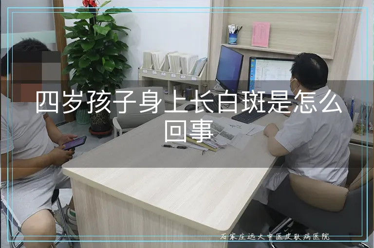 四岁孩子身上长白斑是怎么回事