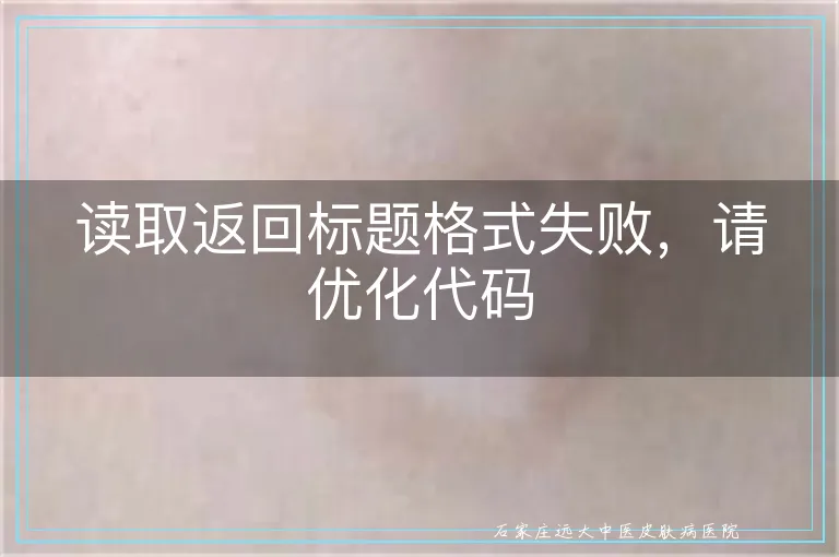读取返回标题格式失败，请优化代码