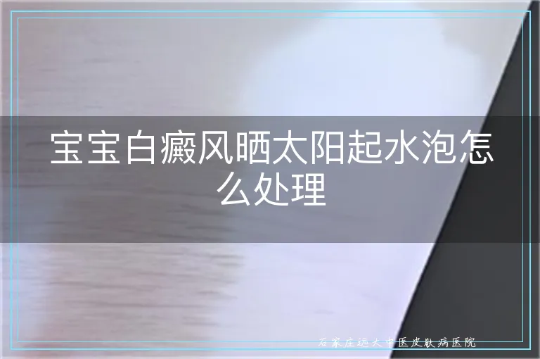 宝宝白癜风晒太阳起水泡怎么处理