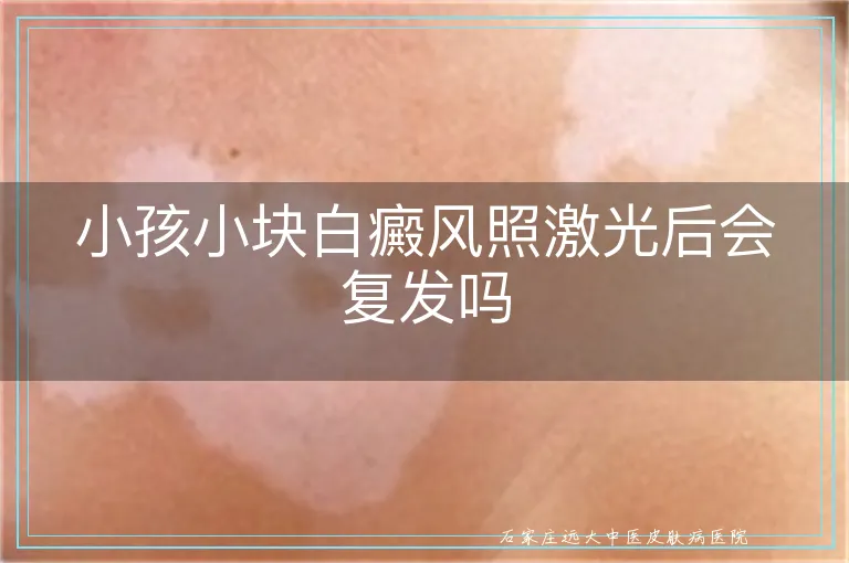 小孩小块白癜风照激光后会复发吗