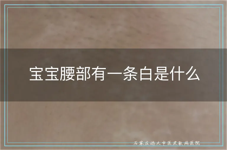 宝宝腰部有一条白是什么