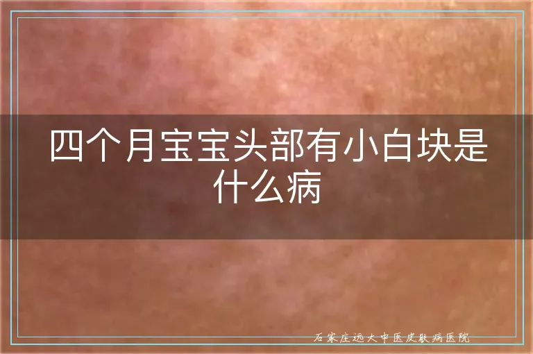 四个月宝宝头部有小白块是什么病