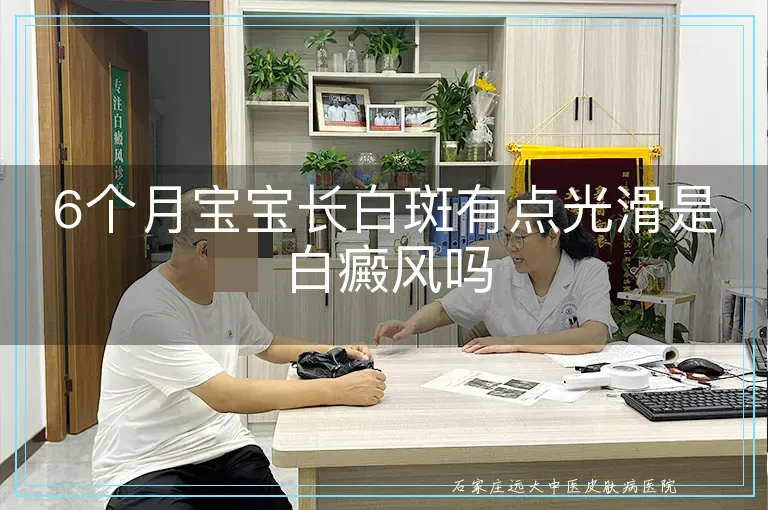 6个月宝宝长白斑有点光滑是白癜风吗